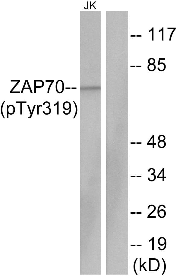 ZAP70 Antibody (phospho-Tyr319)