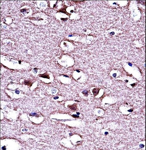 Polyclonal Rabbit anti-Human LMO2 Antibody (aa1-30, IHC, WB)