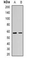 Polyclonal Rabbit anti-Human ADIPOR1/Adiponectin Receptor 1 Antibody (IF, WB)