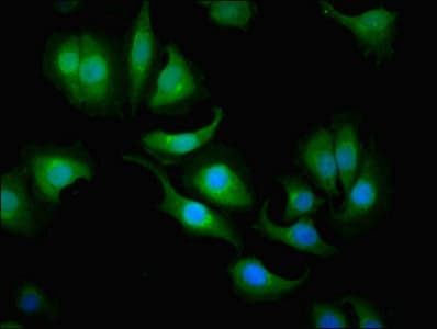 CA1 / Carbonic Anhydrase I Antibody