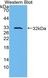 PLAU / Urokinase / uPA Antibody (aa180-433)