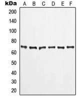 LIMK1 / LIMK Antibody (Internal)