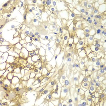SDC1 / Syndecan 1 / CD138 Antibody