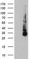 KCNJ3 / GIRK1 Antibody (aa279-501, clone OTI2E4, Carrier-free)