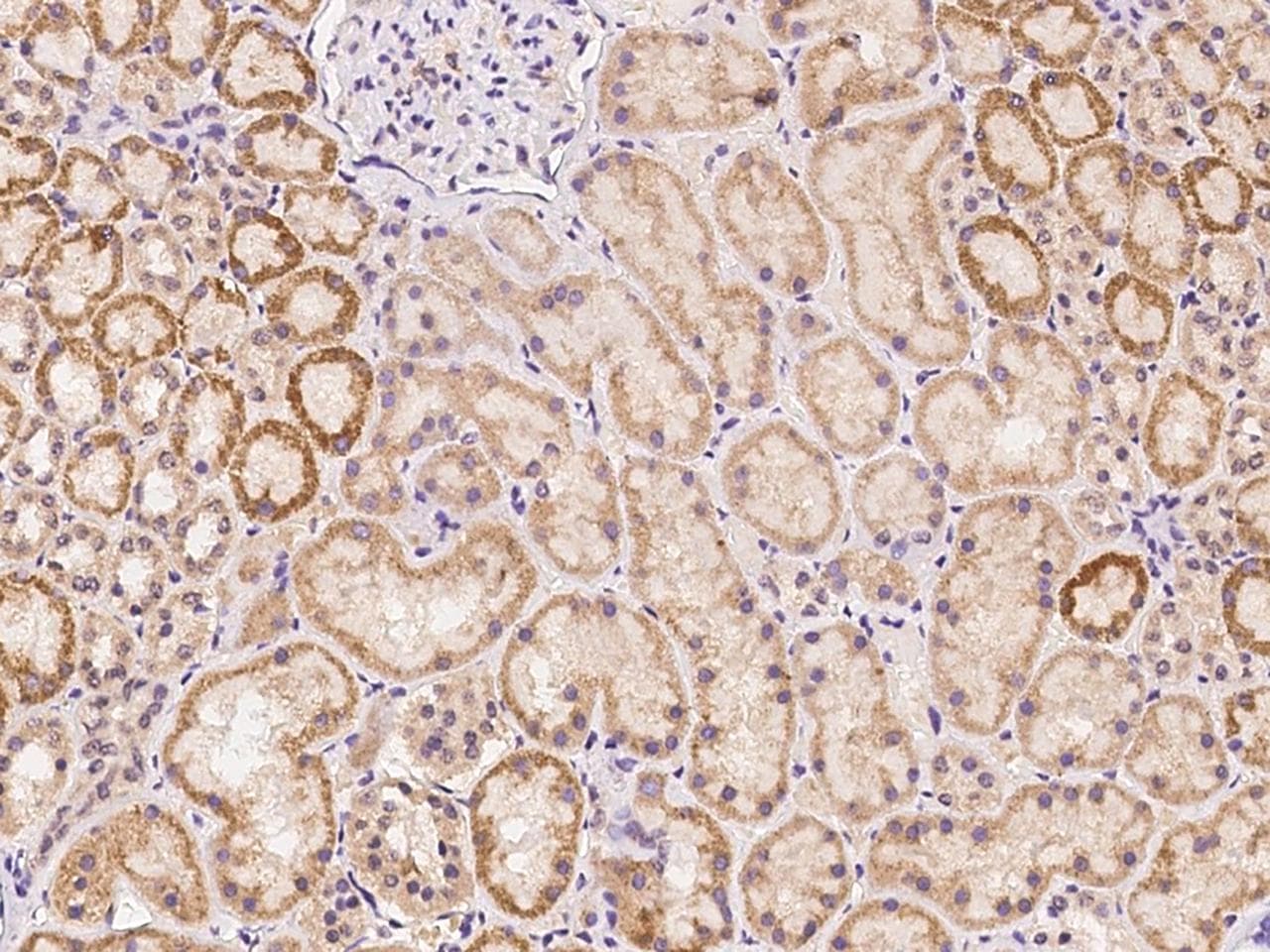 Polyclonal Rabbit anti-Human TLCD1 Antibody (IHC)