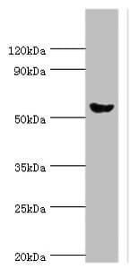 Polyclonal Rabbit anti-Human AMY2A / Pancreatic Amylase Antibody (aa242-511, IHC, WB)