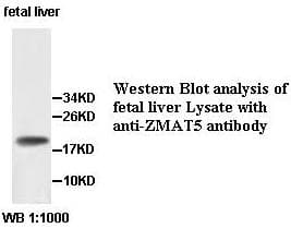 ZMAT5 Antibody (aa1-170)