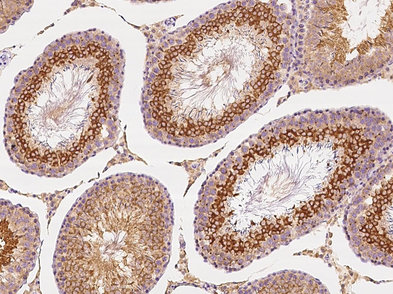 ANGEL1 Antibody