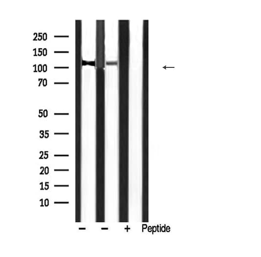 PPP1R12A / MYPT1 Antibody (phospho-Thr853)