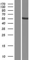 PRAMEF16 Protein (Over-Expression Lysate Myc-DDK (Flag))