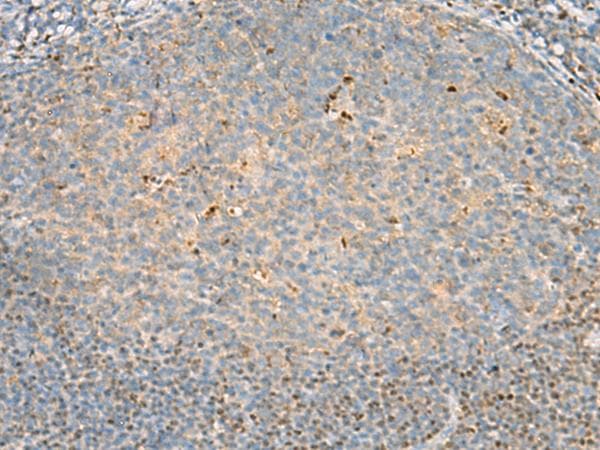 DNPEP Antibody