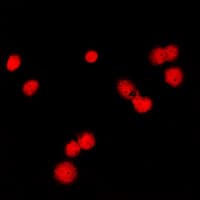 MSH6 Antibody (Internal)