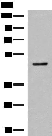Polyclonal Rabbit anti-Human SCRN2 / Ses2 Antibody (IHC, WB)