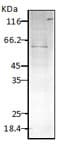 HSPD1 / HSP60 Antibody (APC)