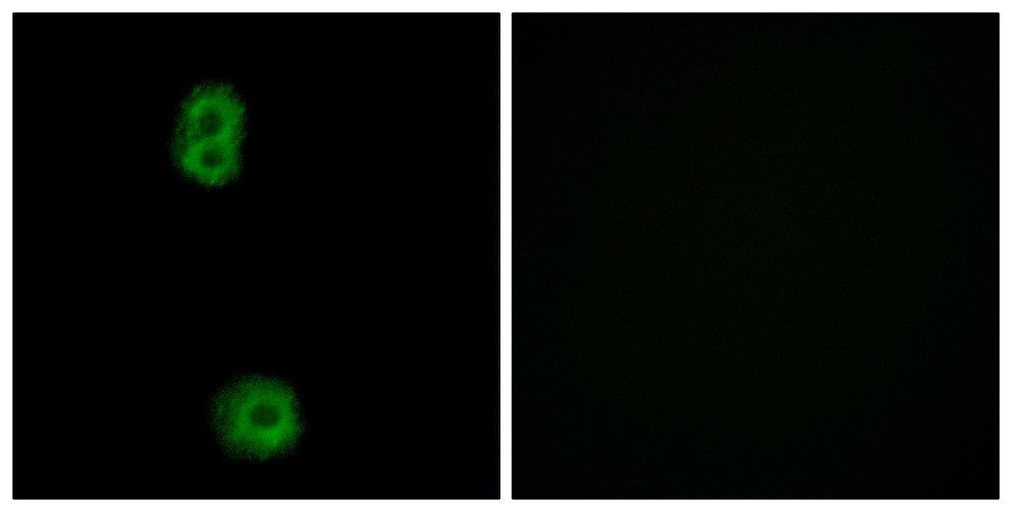 Polyclonal Rabbit anti-Human PBOV1 Antibody (IHC, IF, WB)