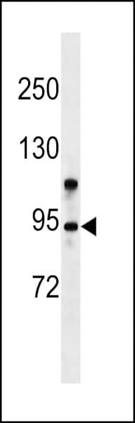 ZMYM6 Antibody (aa183-210)