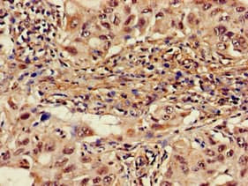 Polyclonal Rabbit anti-Human ALAS1 Antibody (IHC)