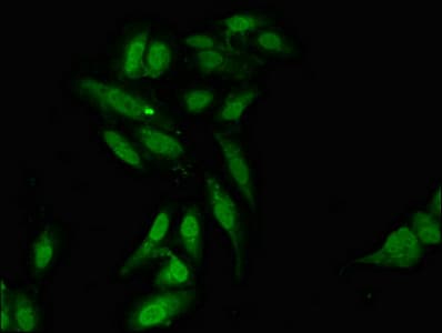 Polyclonal Rabbit anti-Human L3MBTL2 Antibody (IF, WB)