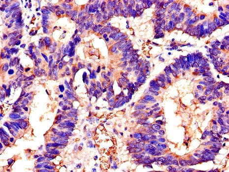 Polyclonal Rabbit anti-Human SWI5 / C9orf119 Antibody (IHC, WB)