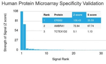 ERBB2 / HER2 Antibody (clone ERBB2/2452)