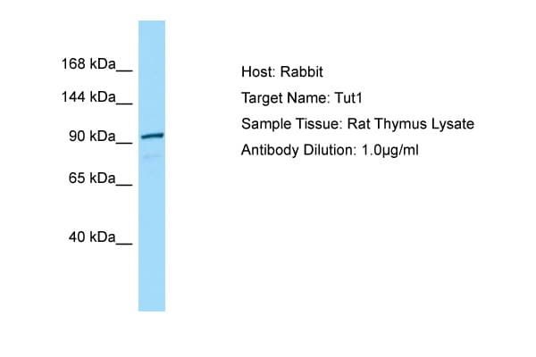 TUT1 Antibody (N-Terminus)