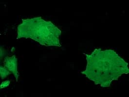 Monoclonal Mouse anti-Human MOBKL2B / MOB3B Antibody (clone OTI2H8, IF, WB)