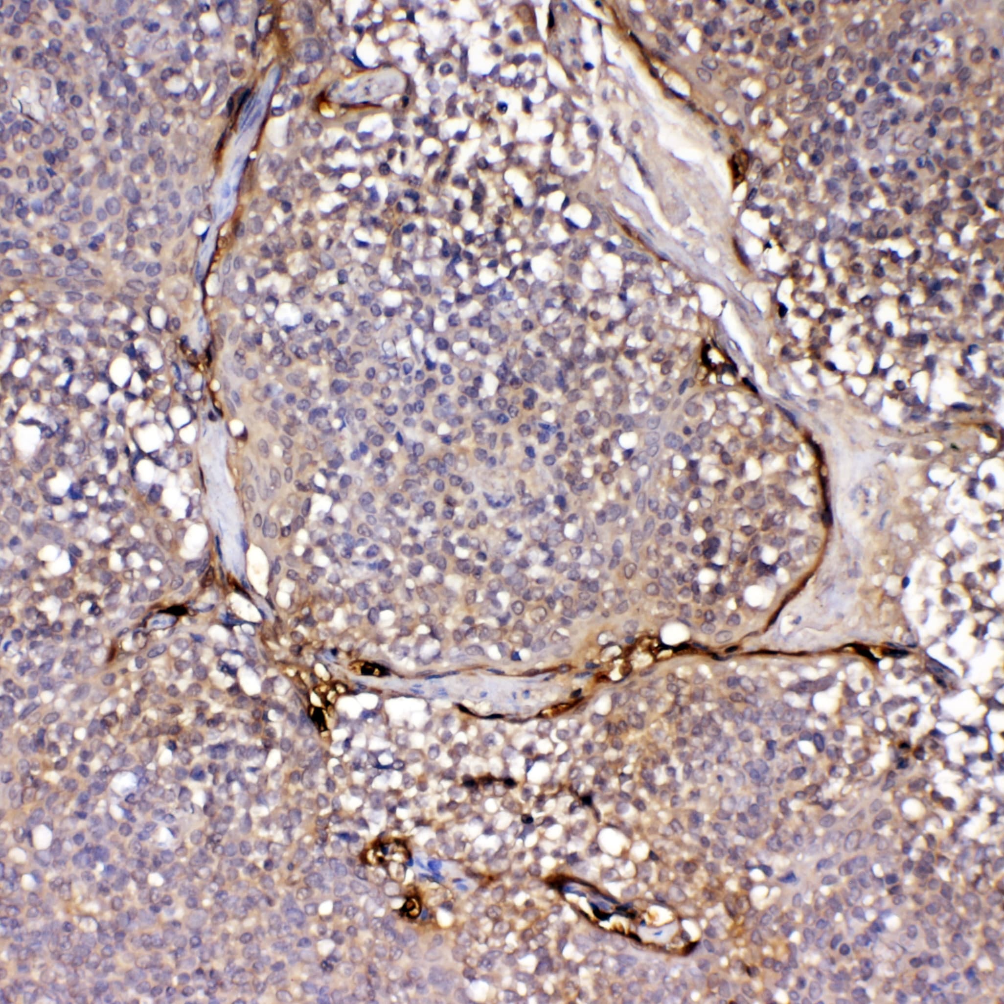 IL1F10 Antibody