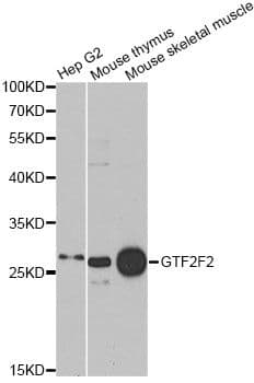 RAP30 / GTF2F2 Antibody