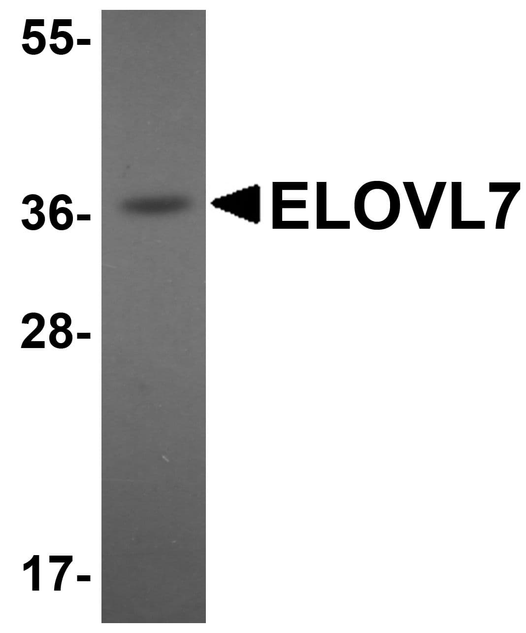 IHC-plus™ ELOVL7 Antibody