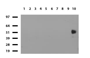 Monoclonal Mouse anti-Human CD2 Antibody (clone UMAB6, Carrier-free, IHC, IF, WB)