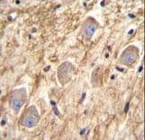 Polyclonal Rabbit anti-Human PCDHGA8 Antibody (aa781-808, IHC, IF, WB)