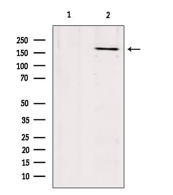 Polyclonal Rabbit anti-Human COL17A1 / Collagen XVII Antibody (IHC, IF, WB)