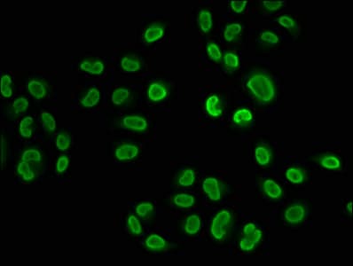 HIST1H2BN Antibody