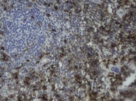 Monoclonal Mouse anti-Human F13A1 / Factor XIIIa Antibody (clone OTI3G12, IHC, WB)