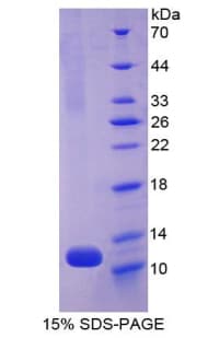 Rat NPPA / ANP Protein (Recombinant GST)