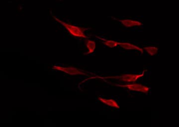 Polyclonal Rabbit anti-Human SYK Antibody (phospho-Tyr348, IHC, IF, WB)