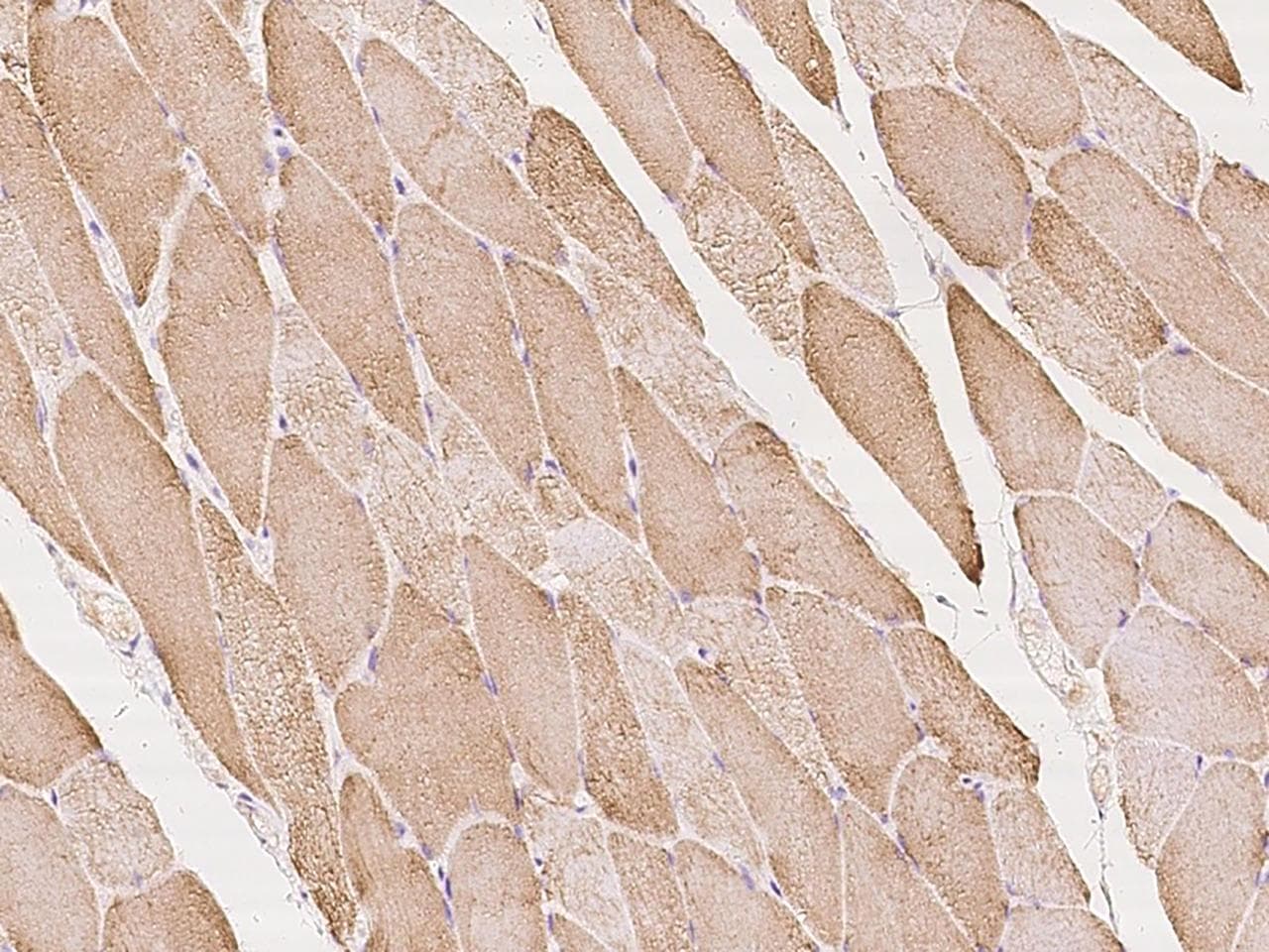 Polyclonal Rabbit anti-Human TNK2 / ACK1 Antibody (IHC)