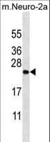 Polyclonal Rabbit anti-Human ZCRB1 Antibody (aa184-212, IHC, WB)