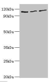 IHC-plus™ Polyclonal Rabbit anti-Human MER / MERTK Antibody (aa840-999, IHC, WB)