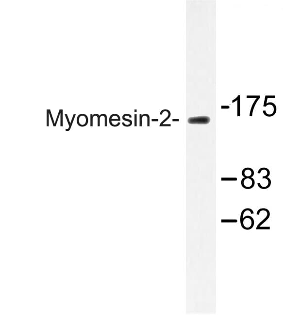 MYOM2 / Myomesin 2 Antibody (Tyr644)