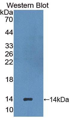 HAVCR1 / KIM-1 Antibody (aa23-125, APC)