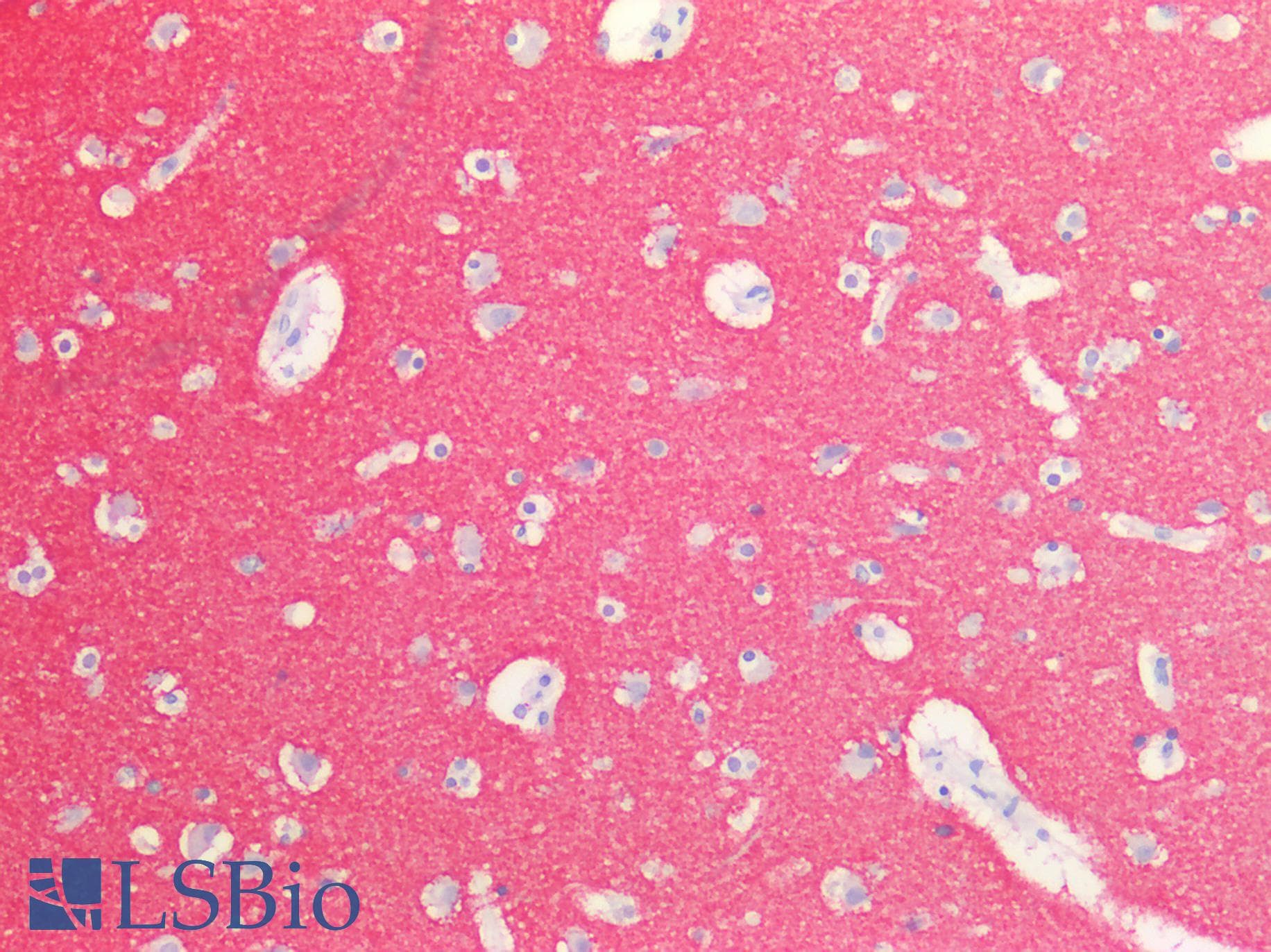 IHC-plus™ LRRC8A / LRRC8 Antibody (aa760-810)