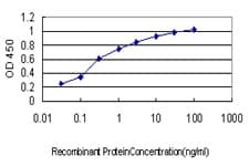 EPHA2 / EPH Receptor A2 Antibody (clone 6F8)