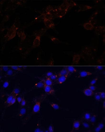 CD44 Antibody