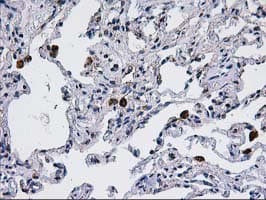 CCM2 / Malcavernin Antibody (clone OTI1E9)