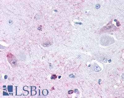 PathPlus™ GPRC6A Antibody (N-Terminus)
