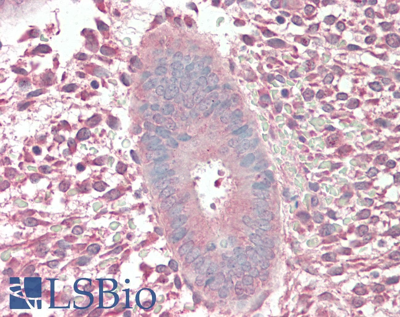 AMHR2 / MISRII Antibody (N-Terminus)
