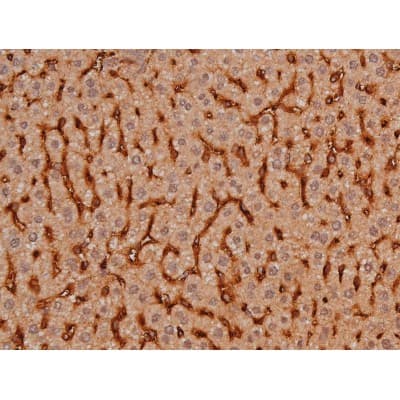 MAPT / Tau Antibody (phospho-Ser262)