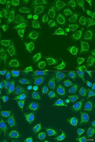 ALG2 Antibody