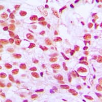 ELK1 Antibody (phospho-Ser389)